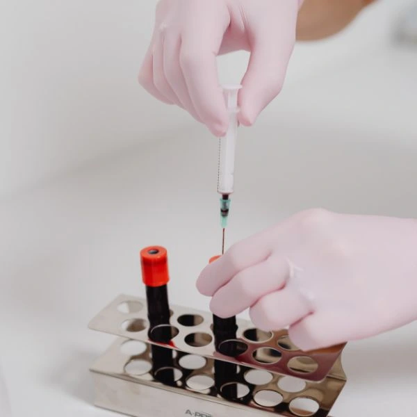 plasma-rico-en-plaquetas